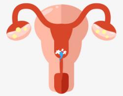 免疫不孕-昆明妇科医院